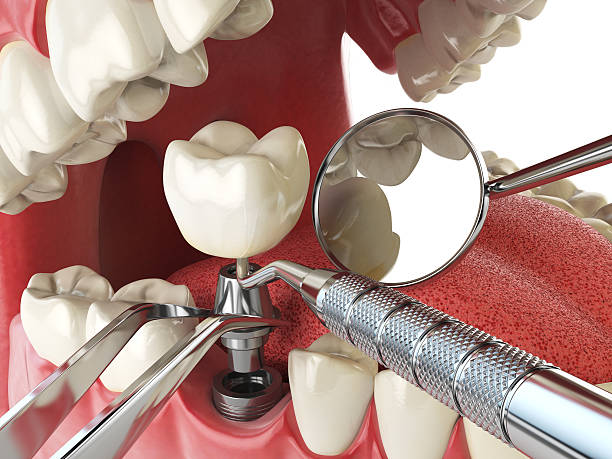 Best Emergency Care for Gum Disease in Johnston, SC