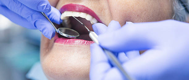 Best Emergency Cosmetic Dentistry (e.g., broken veneers) in Johnston, SC